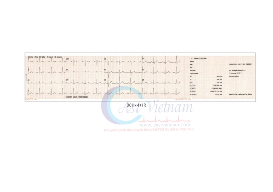 Máy điện tim 3 kênh EM-301